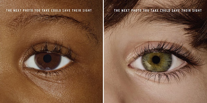 Two images of children's eyes (MODELS)