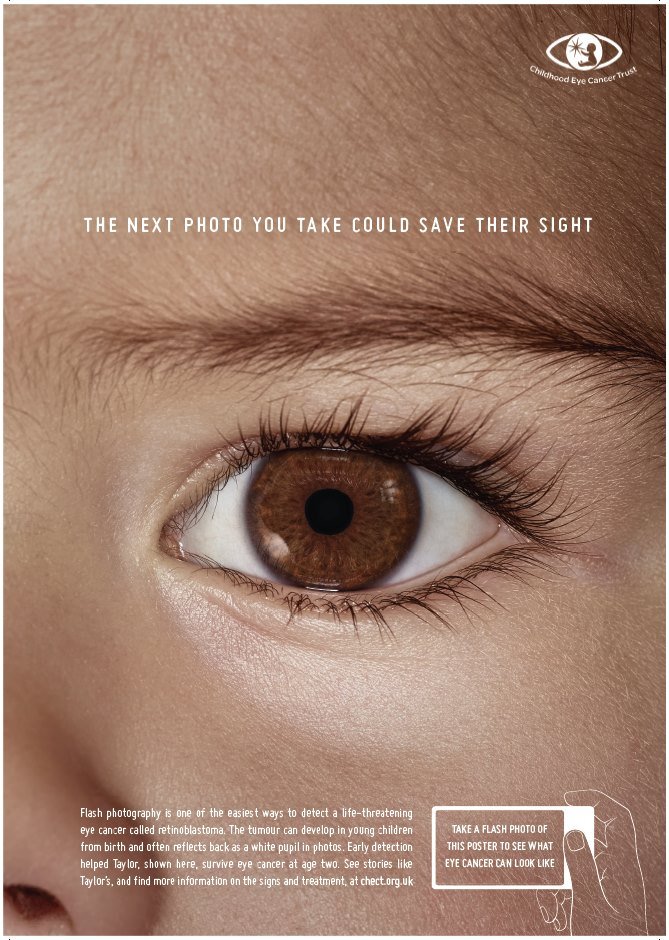 CHECT Ad 1 of child's eye.