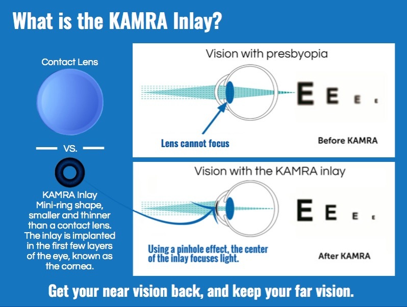 KAMRA